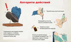 Столбняк — симптомы и лечение
