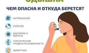 Одышка – причины, симптомы и лечение
