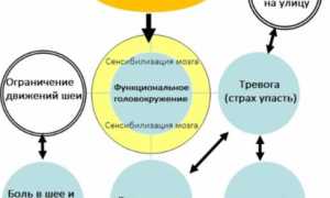 Головокружение — причины, симптомы и лечение головокружения