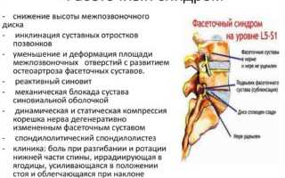 Где находится поясница у человека