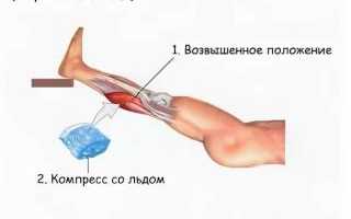 Что делать при разрыве икроножной мышцы