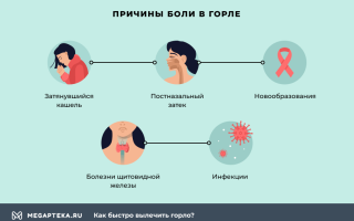 Болит горло – причины, что делать, чем лечить, лекарства и народные средства