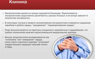 Экстрасистолия – причины, симптомы, диагностика, лечение и профилактика