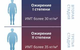 Ожирение — степени, причины, диета и лечение ожирения