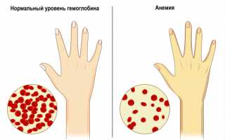 Бледная кожа – причины и лечение